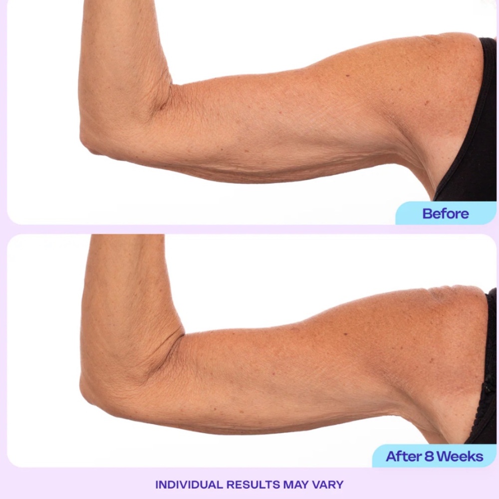 GOPURE Sculpt & Tone Arm Cream - Picture 4 of 6